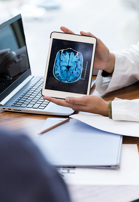 Doctor showing brain scan