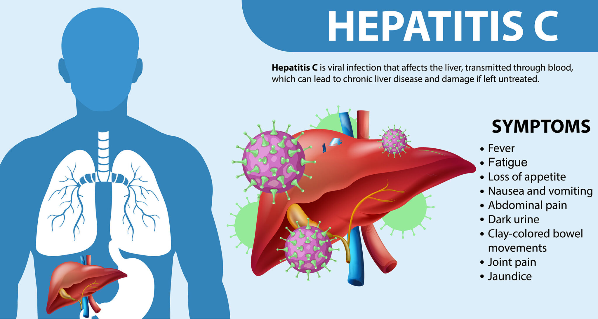 Hepatitis C What You Should Know Healthy Homefront