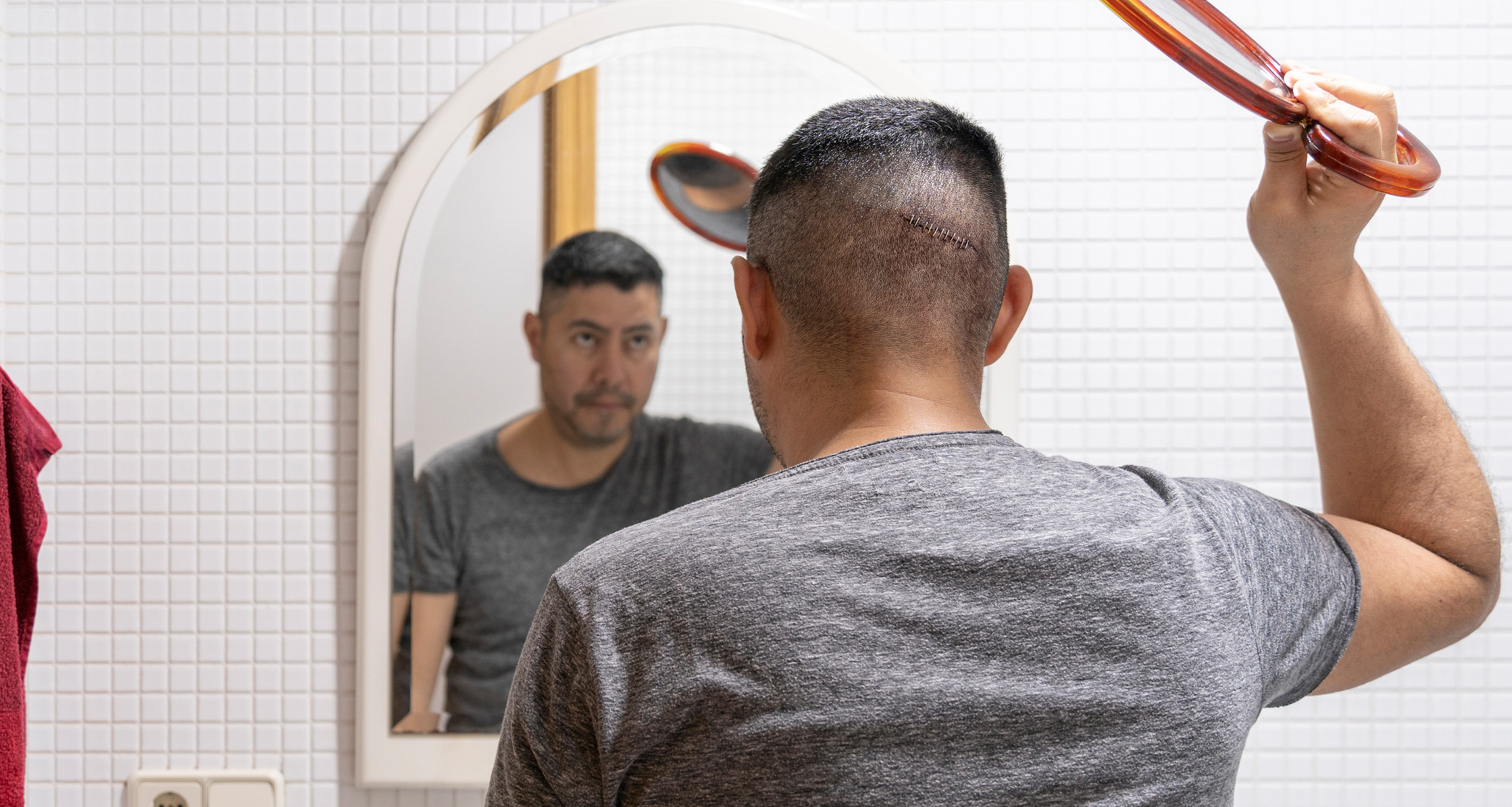 A Service member is checking his head wound using mirrors after surgery.