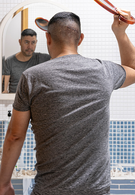 A Service member is checking his head wound using mirrors after surgery.