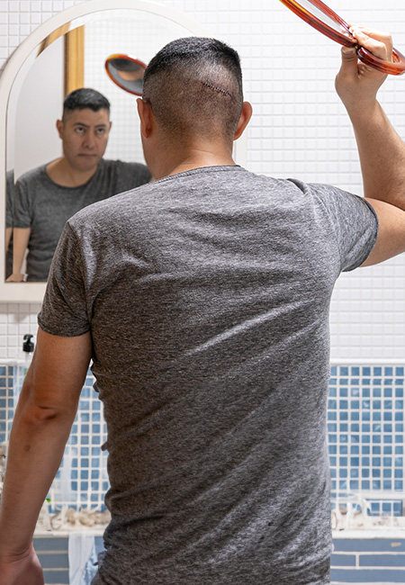 A Service member is checking his head wound using mirrors after surgery.